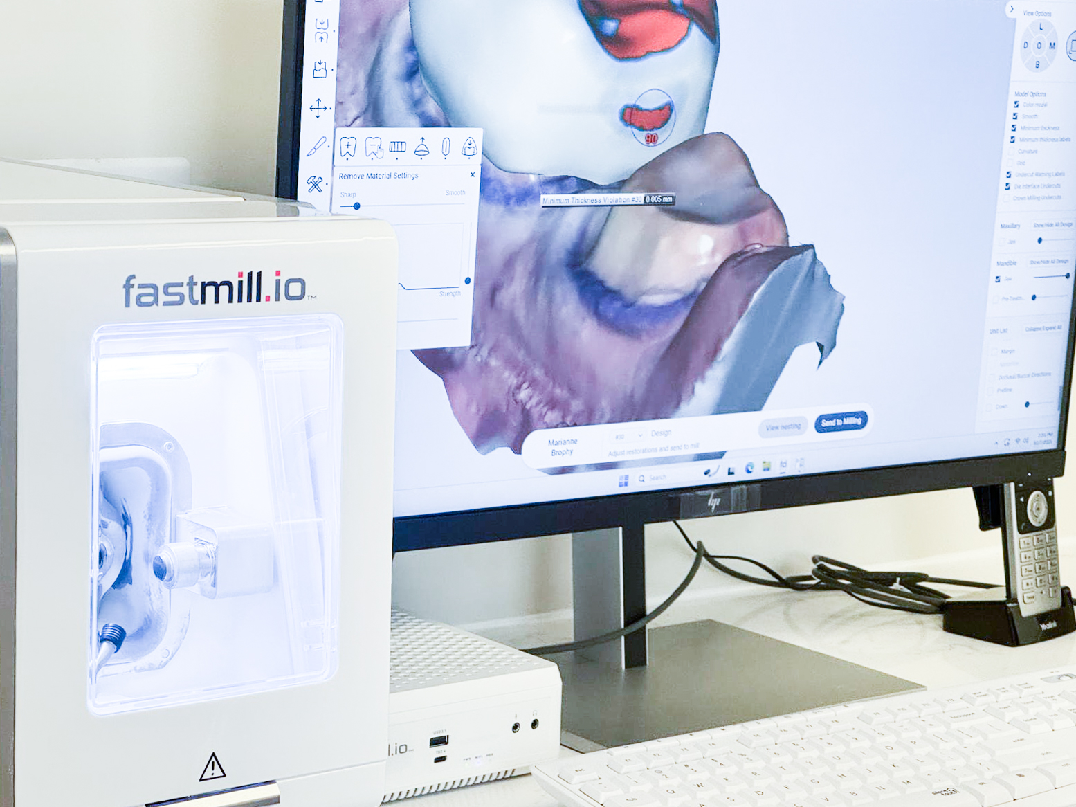 In-office same-day crown milling machine with digital design on screen